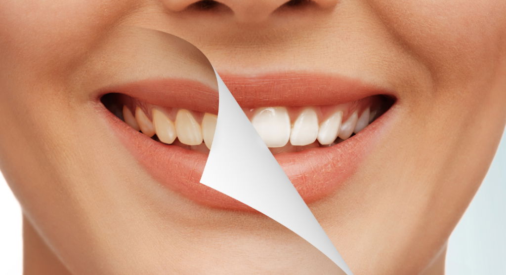 smiling lady showing teeth