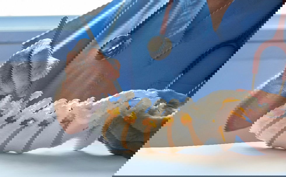 surgeon explaining procedure with pencil on plastic spine