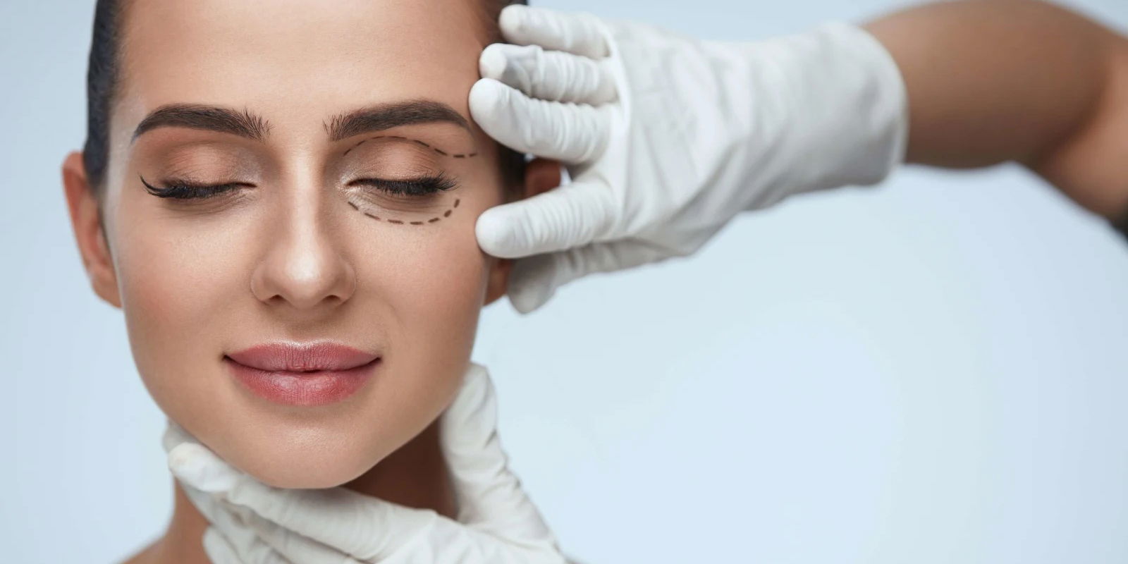 lady patient face with pencil lines for cosmetic surgery
