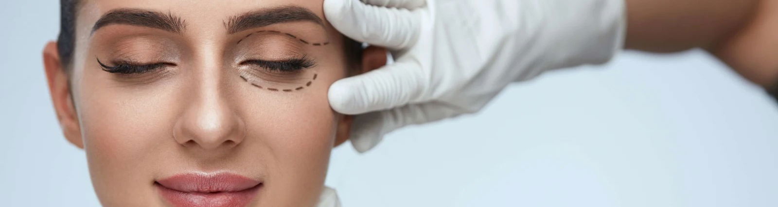 lady patient face with pencil lines for cosmetic surgery