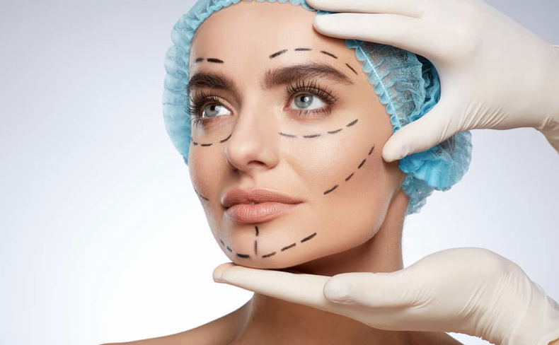 patent head held by nurse's hands in latex gloves prepped for cosmetic facial surgery with marker lines patent head held by nurse's hands in latex gloves prepped for cosmetic facial surgery with marker lines