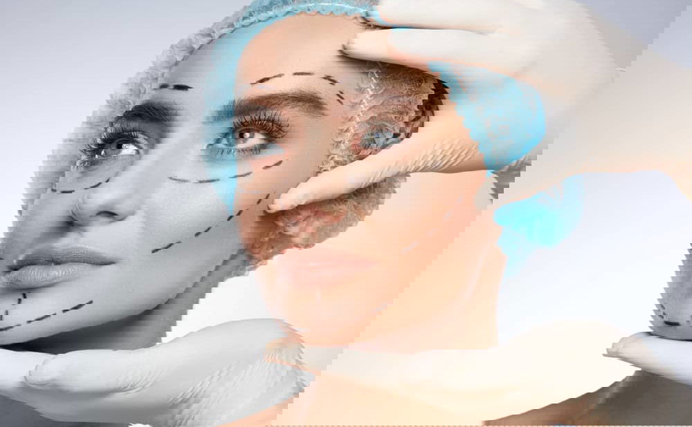 patent head held by nurse&#39;s hands in latex gloves prepped for cosmetic facial surgery with marker lines