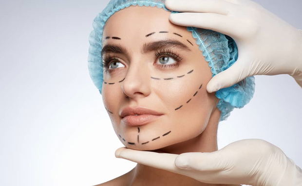 patent head held by nurse's hands in latex gloves prepped for cosmetic facial surgery with marker lines patent head held by nurse's hands in latex gloves prepped for cosmetic facial surgery with marker lines