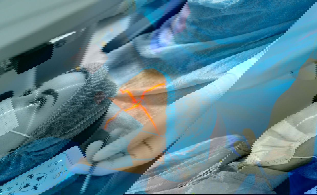 patient with cross laser light on eye waiting for ophthalmic surgery