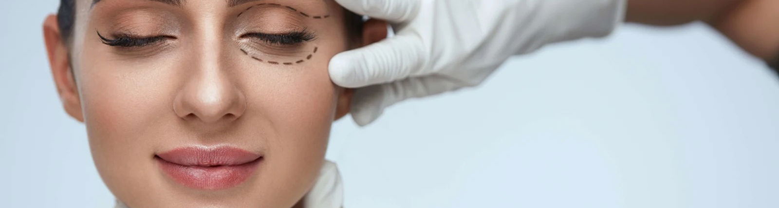 lady face with pencil lines for surgery